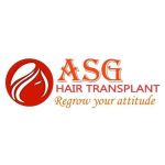 ASG Hair TRansplant