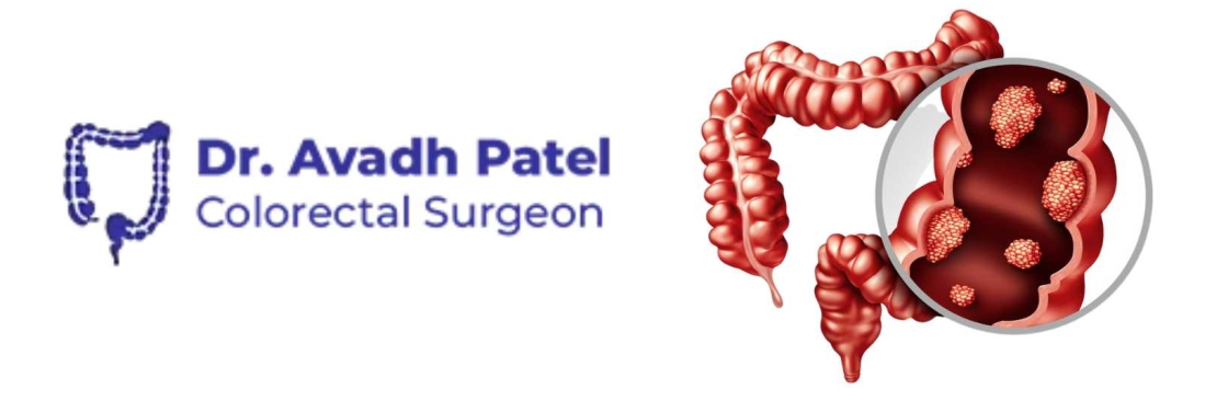 Dr. Avadh Patel Cover Image