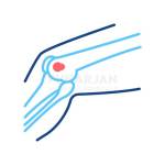 Bone Cancer Treatment Profile Picture