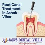 Root Canal