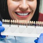 dental veneer Islamabad