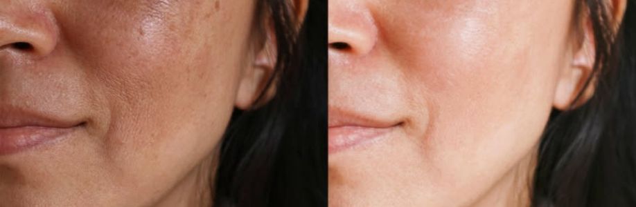 Wymore Laser Cover Image